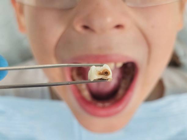 Best Emergency Dental Clinic in MT